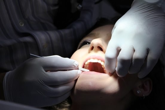 dental-filling